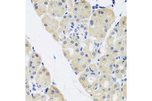 Immunohistochemistry of paraffin-embedded human stomach using ALAD antibody (ABIN5974581) at dilution of 1/100 (40x lens). (ALAD Antikörper)