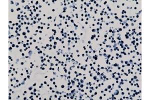 ICC staining of human HepG2 cells with recombinant H3K79me2 antibody. (Rekombinanter Histone 3 Antikörper  (H3K79me2))