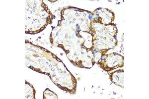 Immunohistochemistry of paraffin-embedded Human placenta using IFN antibody (ABIN3015562, ABIN3015563, ABIN3015564 and ABIN6218872) at dilution of 1:100 (40x lens). (IFNAR2 Antikörper  (AA 27-243))