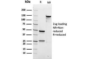 SDS-PAGE Analysis Purified SPTBN2 Recombinant Mouse Monoclonal Antibody (rSPTBN2/1778). (Rekombinanter Spectrin, Beta, Non-erythrocytic 2 (SPTBN2) (AA 356-475) Antikörper)