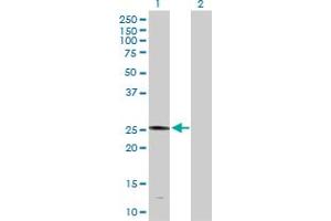 Western Blot analysis of PLA2G4D expression in transfected 293T cell line by PLA2G4D MaxPab polyclonal antibody. (PLA2G4D Antikörper  (AA 1-216))