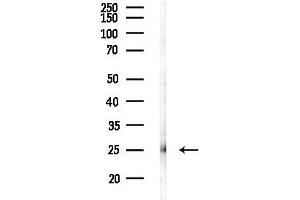 Western blot analysis of lysates from PC12 cells(UV,30 min treatment), using eEF1 Antibody at 1/1000 dilution.