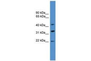 Image no. 1 for anti-ADP-Ribosylation Factor Interacting Protein 1 (ARFIP1) (C-Term) antibody (ABIN6746382)
