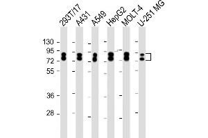 Western Blotting (WB) image for anti-Heterogeneous Nuclear Ribonucleoprotein R (HNRNPR) (AA 95-123), (N-Term) antibody (ABIN1539662)