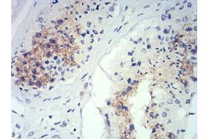 Immunohistochemistry (IHC) image for anti-ATG14 Autophagy Related 14 (ATG14) (AA 43-303) antibody (ABIN5542588)