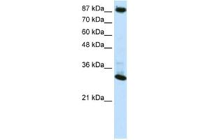 WB Suggested Anti-CTCF Antibody Titration:  0.