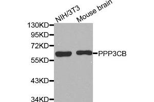 Western Blotting (WB) image for anti-Protein Phosphatase 3, Catalytic Subunit, beta Isozyme (PPP3CB) antibody (ABIN1874234) (PPP3CB Antikörper)