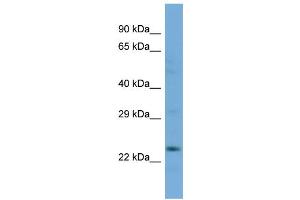 Host:  Rabbit  Target Name:  SLC13A3  Sample Type:  COLO205 Whole cell lysates  Antibody Dilution:  1. (SLC13A3 Antikörper  (N-Term))
