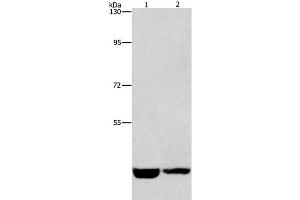 Western Blot analysis of Hela and A431 cell using CSNK1E Polyclonal Antibody at dilution of 1:1550 (CK1 epsilon Antikörper)
