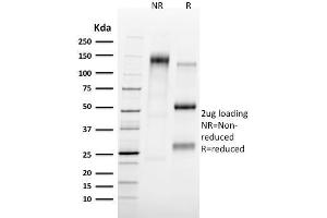 SDS-PAGE Analysis Purified Tal1 Mouse Monoclonal Antibody (TAL1/2707). (TAL1 Antikörper)