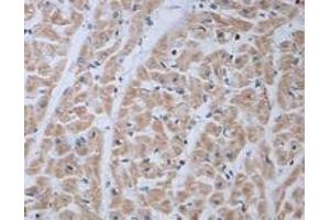 Immunohistochemical staining of formalin-fixed paraffin-embedded human heart showing staining with ADRA1B polyclonal antibody  at 1:100 dilution. (ADRA1B Antikörper)