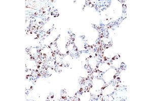 Immunohistochemistry of paraffin-embedded rat lung using ER Rabbit mAb (ABIN7266941) at dilution of 1:100 (40x lens).