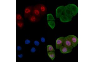 ABIN6256258 and ABIN6267588 staining Hela cells(30 min of UV treatment) by IF/ICC.