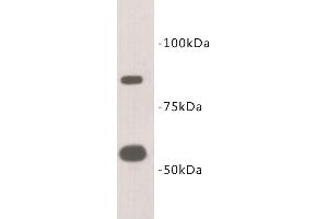 Western Blotting (WB) image for anti-Transmembrane Protein 2 (TMEM2) antibody (ABIN1854991)