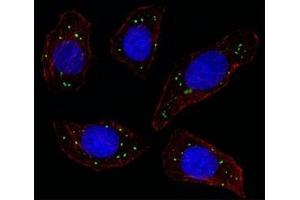 Fluorescent image of U251 cell stained with MERTK antibody at 1:25. (MERTK Antikörper)