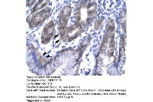 Rabbit Anti-EAP30 Antibody  Paraffin Embedded Tissue: Human Stomach Cellular Data: Epithelial cells of Fundic Gland and Surface Mucous Cells Antibody Concentration: 4. (SNF8 Antikörper  (N-Term))