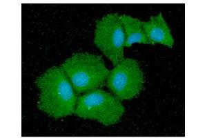 ICC/IF analysis of QPRT in Hep3B cells line, stained with DAPI (Blue) for nucleus staining and monoclonal anti-human QPRT antibody (1:100) with goat anti-mouse IgG-Alexa fluor 488 conjugate (Green). (QPRT Antikörper  (AA 1-297))