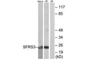 Western blot analysis of extracts from HeLa/Jurkat cells, using SFRS3 Antibody. (SRSF3 Antikörper  (AA 111-160))