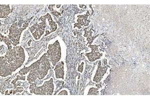 IHC analysis of HDAC5 using anti-HDAC5 antibody (ABIN7599922). (HDAC5 Antikörper  (AA 13-1107))