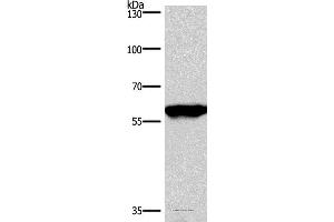 Western blot analysis of Mouse brain tissue, using PPP3CA Polyclonal Antibody at dilution of 1:900