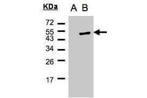 WB Image Western Blot analysis of PSCD1 expression in transfected 293T cell line by PSCD1 polyclonal antibody. (Cytohesin 1 Antikörper)