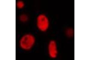 ABIN6274282 staining Hela cells by IF/ICC. (ZNF134 Antikörper)