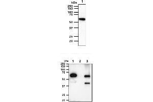 The cell lysates (40ug) were resolved by SDS-PAGE, transferred to PVDF membrane and probed with anti-human AKT1/3 antibody (1:1000). (AKT1/3 Antikörper)