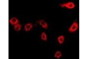 Immunofluorescent analysis of Moesin staining in Hela cells. (Moesin Antikörper)