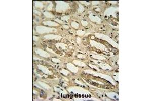 GGTLC2 antibody (Center) (ABIN654174 and ABIN2844032) immunohistochemistry analysis in formalin fixed and paraffin embedded human lung tissue followed by peroxidase conjugation of the secondary antibody and DAB staining. (GGTLC2 Antikörper  (AA 127-154))