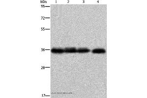 Western blot analysis of K562 cell and  human kidney cancer tissue, 293T and HepG2 cell, using F11R Polyclonal Antibody at dilution of 1:600 (F11R Antikörper)