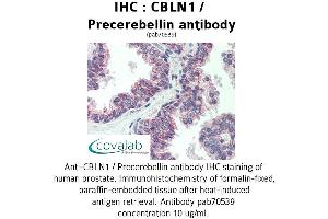 Image no. 1 for anti-Cerebellin 1 Precursor (CBLN1) antibody (ABIN1732717) (CBLN1 Antikörper)