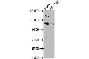 Western Blot Positive WB detected in: HL60 whole cell lysate, SH-SY5Y whole cell lysate All lanes: RAPGEF1 antibody at 1:2000 Secondary Goat polyclonal to rabbit IgG at 1/50000 dilution Predicted band size: 121, 117, 123 kDa Observed band size: 121 kDa (GRF2 Antikörper  (AA 22-40))