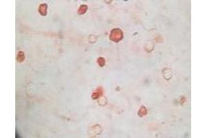 Immunohistochemistry (IHC) image for anti-KSHVK8a antibody (ABIN2464074) (KSHVK8a Antikörper)