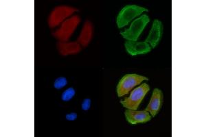 ABIN6258526 and ABIN6274768 staining Hela cells(30 min of UV treatment) by IF/ICC. (RPL12 Antikörper  (C-Term))