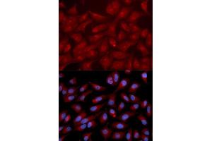 Immunofluorescence analysis of U2OS cells using RAPGEF3 antibody. (RAPGEF3 Antikörper  (AA 1-200))