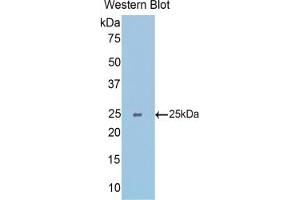 Western blot analysis of the recombinant protein. (SLIT1 Antikörper  (AA 3-211))