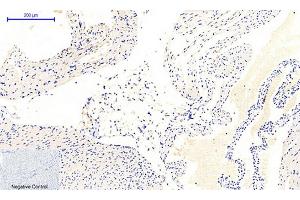 Immunohistochemical analysis of paraffin-embedded mouse heart tissue. (JAK1 Antikörper  (pTyr1022))