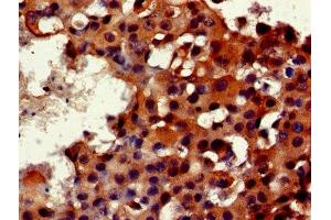 Immunohistochemistry (IHC) image for anti-FK506 Binding Protein 3, 25kDa (FKBP3) (AA 2-224) antibody (ABIN7162833)