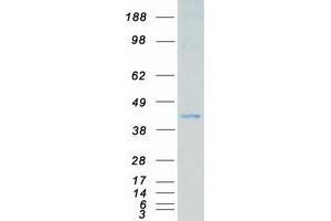 Western Blotting (WB) image for Mitogen-Activated Protein Kinase Kinase 3 (MAP2K3) (Transcript Variant B) protein (Myc-DYKDDDDK Tag) (ABIN2725386)