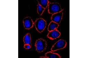 CD44 antibody (ABIN659120 and ABIN2843760) confocal immunofluorescent analysis with hela cell. (CD44 Antikörper)