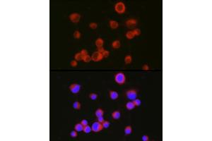 Immunofluorescence analysis of Neuro-2a cells using [KO Validated] CD171/L1CAM Rabbit pAb (ABIN6131538, ABIN6143053, ABIN6143054 and ABIN7101826) at dilution of 1:150 (40x lens). (L1CAM Antikörper  (AA 1143-1257))