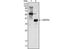 Western blot analysis using MATK antibody against K562 cell lysate (1). (MATK Antikörper)