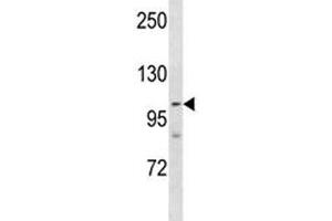 PARP 1 antibody western blot analysis in NCI-H460 lysate. (PARP1 Antikörper  (AA 590-618))