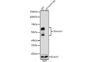 Western blot analysis of extracts from wild type (WT) and Vimentin knockout (KO) 293T cells, using Vimentin antibody (ABIN7271326) at 1:1000 dilution.