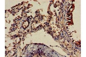 Immunohistochemistry of paraffin-embedded human lung tissue using ABIN7174020 at dilution of 1:100 (Fgr Antikörper  (AA 11-72))