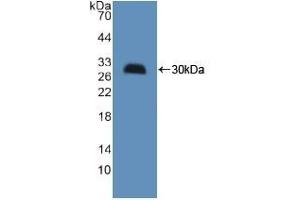 Detection of Recombinant HMGCS, Mouse using Polyclonal Antibody to Hydroxymethylglutaryl Coenzyme A Synthase (HMGCS) (HMGCS1 Antikörper  (AA 1-238))
