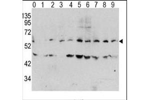 Western blot analysis of phospho c-Myc antibody and human TPA activated HeLa cells/lysate (0: without TPA (c-MYC Antikörper  (pThr58))