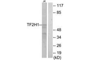 Western blot analysis of extracts from Jurkat cells, using TF2H1 Antibody. (GTF2H1 Antikörper  (AA 15-64))