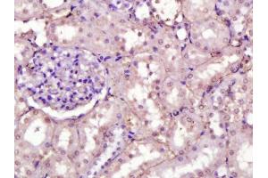 Paraformaldehyde-fixed, paraffin embedded rat kidney, Antigen retrieval by boiling in sodium citrate buffer (pH6) for 15min, Block endogenous peroxidase by 3% hydrogen peroxide for 30 minutes, Blocking buffer (normal serum) at 37°C for 20min, Antibody incubation with Fibronectin (1B9) Monoclonal Antibody  at 1:200 overnight at 4°C, followed by a conjugated secondary and DAB staining.