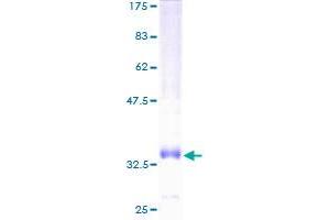 CCL14 Protein (AA 20-93) (GST tag)